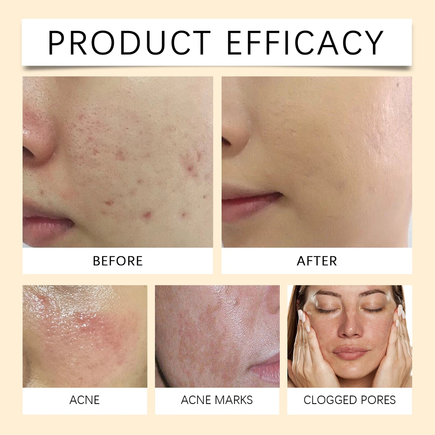Bee Venom Skin Relief Cream